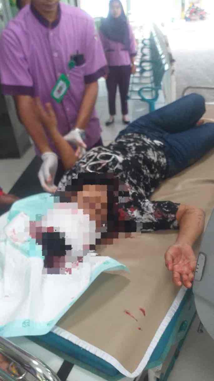 Mantan Suami Aniaya Perempuan di Blitar, Polisi Lakukan Pengejaran FK (29) Menjadi Korban Penganiayaan oleh Mantan Suami EP hingga Mengalami Luka-luka dan Menjalani Perawatan di Rumah Sakit