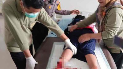 Seorang Anak Kakinya Terjepit Roda Motor saat Mudik Lebaran sedang Menjalani Perawatan di Rumah Sakit