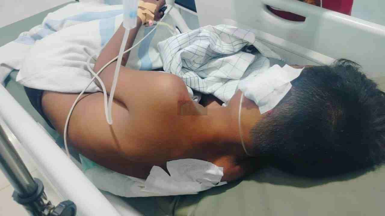 Bocah 11 Tahun di Srengat Dibacok Pasien Gangguan Jiwa, Begini Kondisinya Kondisi Korban MKS sedang dalam perawatan medis